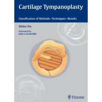 Cartilage Tympanoplasty