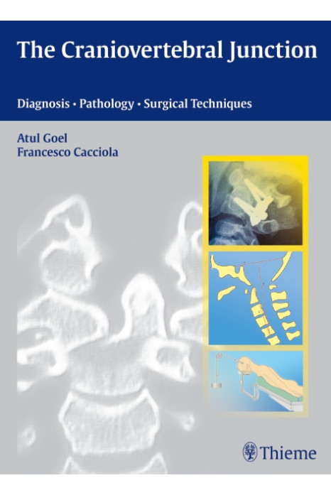 The Craniovertebral Junction