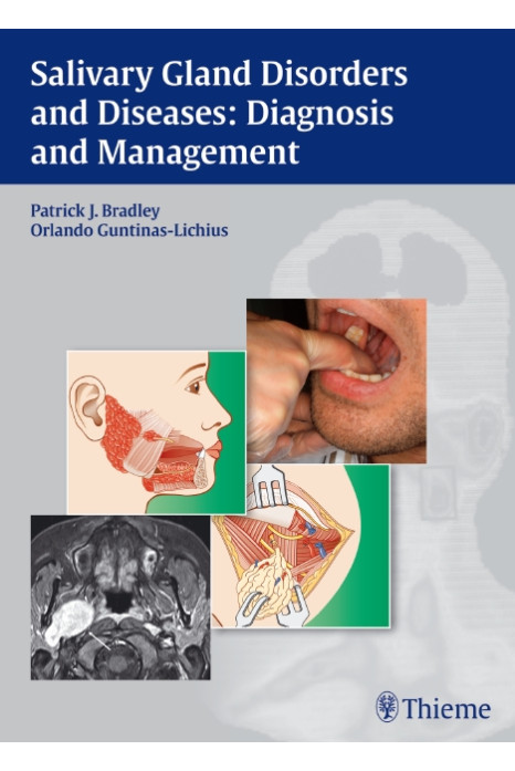 Salivary Gland Disorders and Diseases