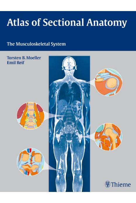 Atlas of Sectional Anatomy