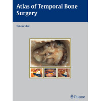 Atlas of Temporal Bone Surgery