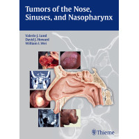 Tumors of the Nose, Sinuses and Nasopharynx