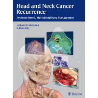 Head and Neck Cancer Recurrence