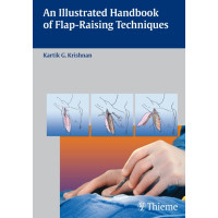 An Illustrated Handbook of Flap-Raising Techniques