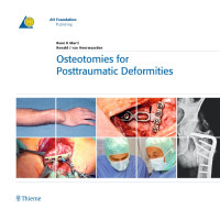 Osteotomies for Posttraumatic Deformities