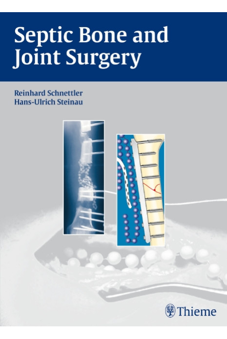 Septic Bone and Joint Surgery