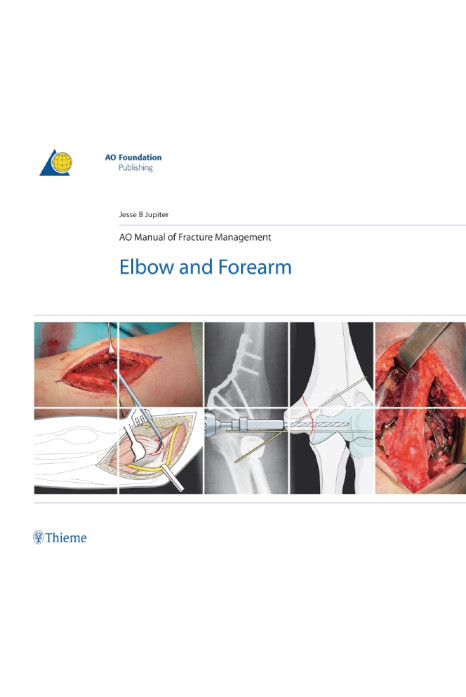 AO Manual of Fracture Management - Elbow & Forearm