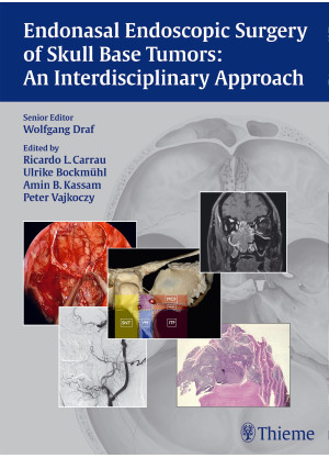 Endonasal Endoscopic Surgery of Skull Base Tumors