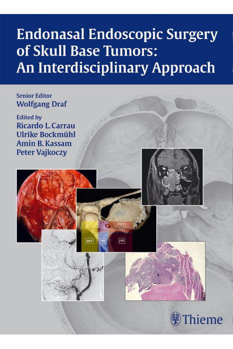 Endonasal Endoscopic Surgery of Skull Base Tumors