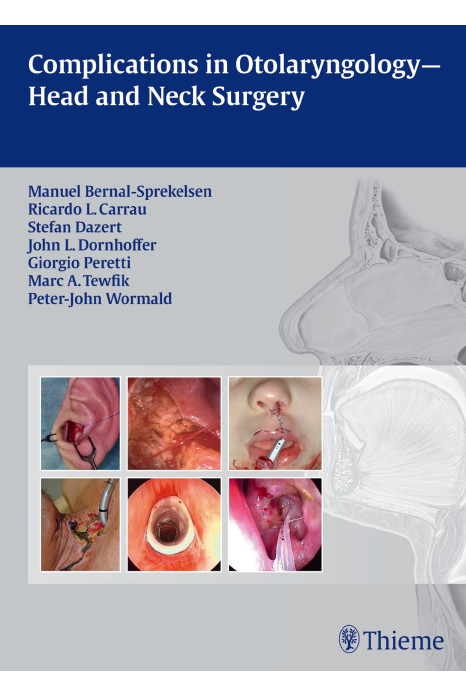 Complications in Otolaryngology - Head and Neck Surgery