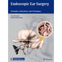 Endoscopic Ear Surgery