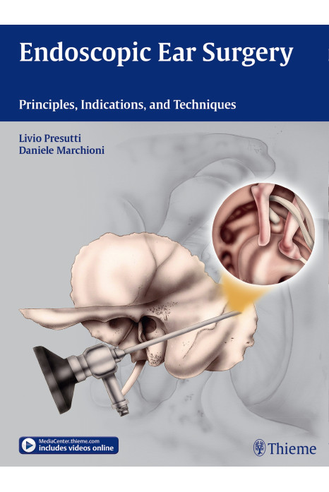 Endoscopic Ear Surgery