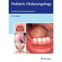 Pediatric Otolaryngology