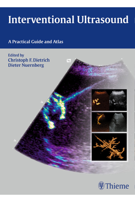 Interventional Ultrasound