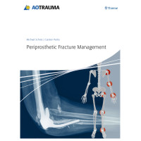 Periprosthetic Fracture Management