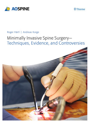 Minimally Invasive Spine Surgery - Techniques, Evidence, and Controversies