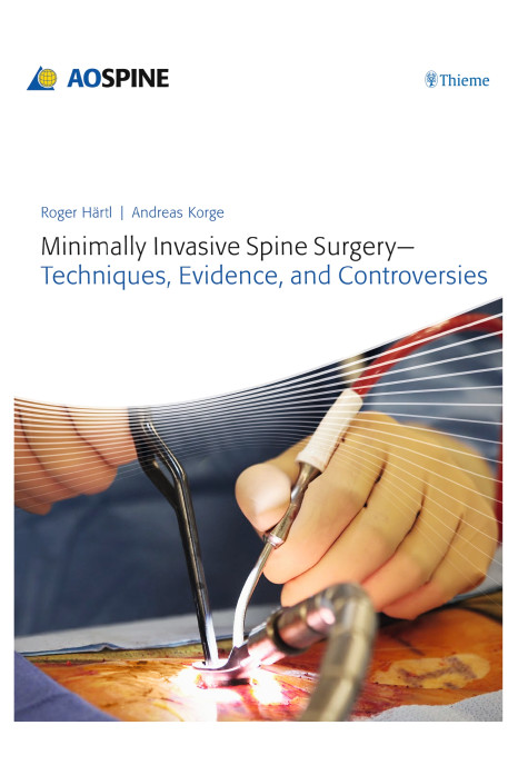 Minimally Invasive Spine Surgery - Techniques, Evidence, and Controversies