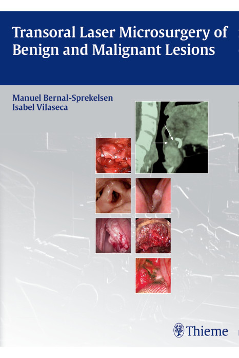 Transoral Laser Microsurgery of Benign and Malignant Lesions