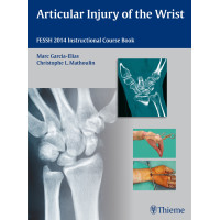 Articular Injury of the Wrist