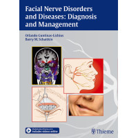 Facial Nerve Disorders and Diseases