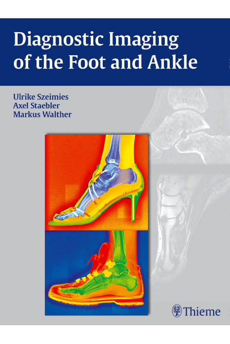 Diagnostic Imaging of the Foot and Ankle