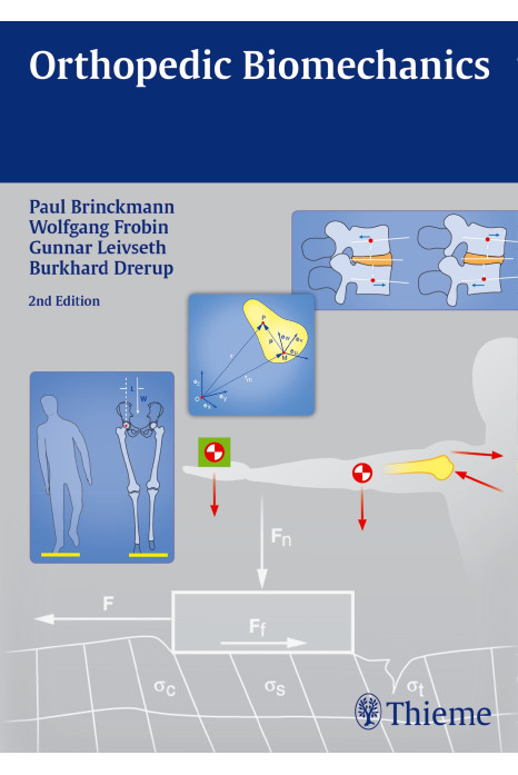 Orthopedic Biomechanics