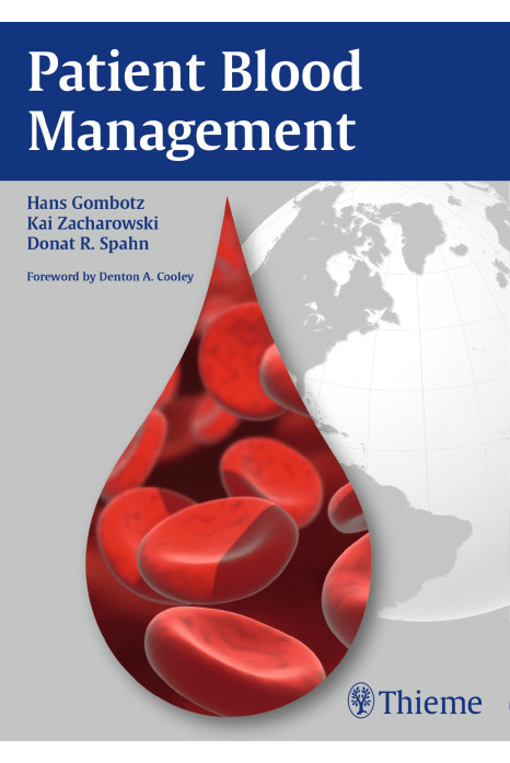 Patient Blood Management