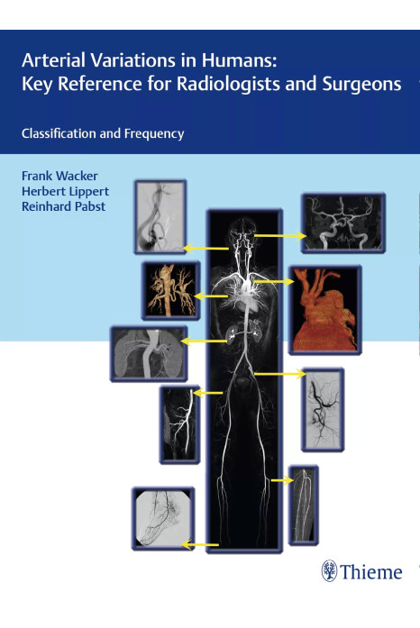 Arterial Variations in Humans