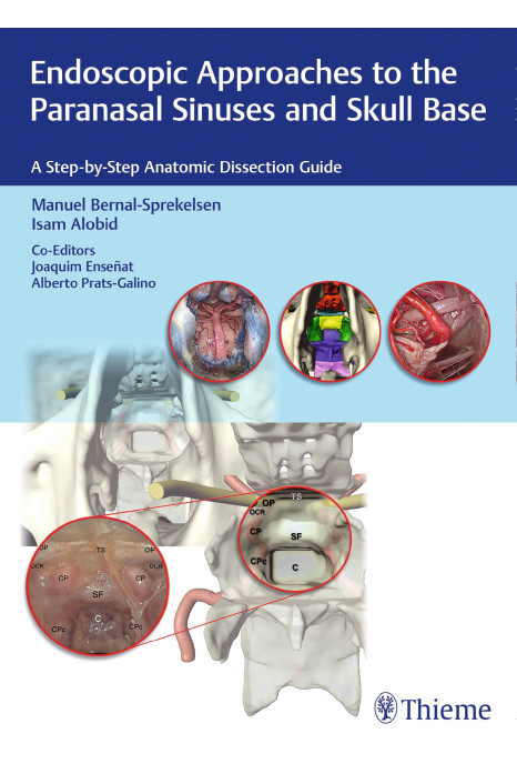 Endoscopic Approaches to the Paranasal Sinuses and Skull Base