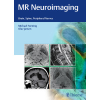 MR Neuroimaging