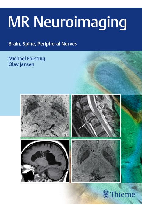 MR Neuroimaging