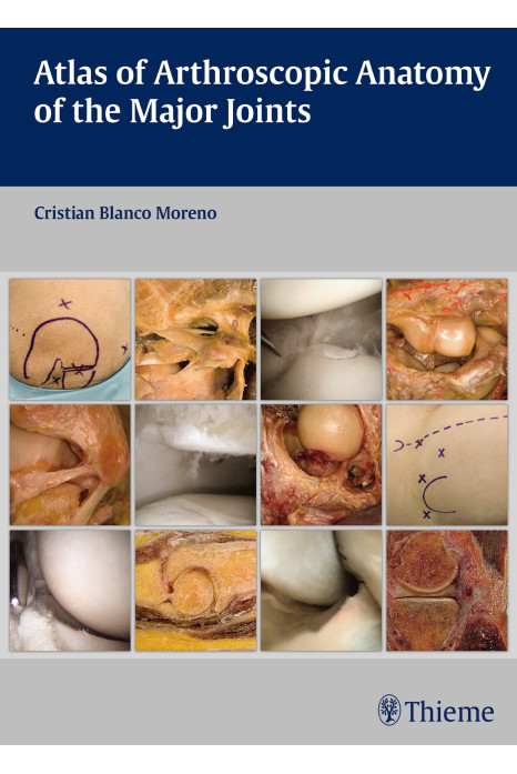 Atlas of Arthroscopic Anatomy of the Major Joints