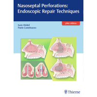 Nasoseptal Perforations