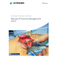 Manual of Fracture Management - Hand