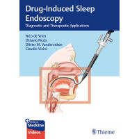 Drug-Induced Sleep Endoscopy