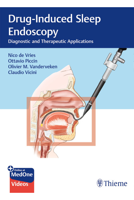 Drug-Induced Sleep Endoscopy