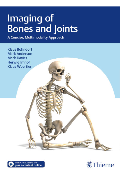 Imaging of Bones and Joints