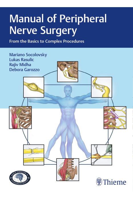 Manual of Peripheral Nerve Surgery