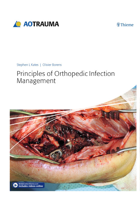 Principles of Orthopedic Infection Management