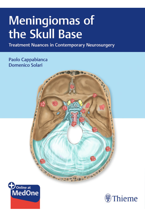 Meningiomas of the Skull Base