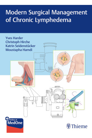 Modern Surgical Management of Chronic Lymphedema