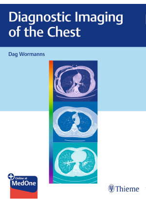 Diagnostic Imaging of the Chest