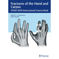 Fractures of the Hand and Carpus