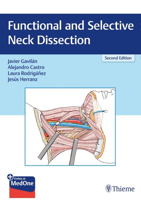 Functional and Selective Neck Dissection