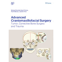 Advanced Craniomaxillofacial Surgery