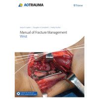 Manual of Fracture Management - Wrist