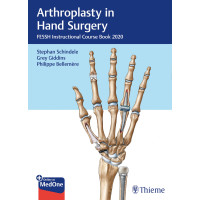 Arthroplasty in Hand Surgery