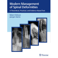 Modern Management of Spinal Deformities