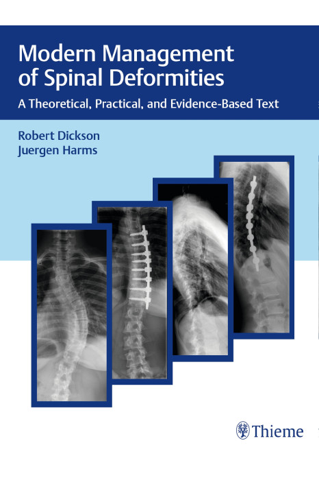 Modern Management of Spinal Deformities