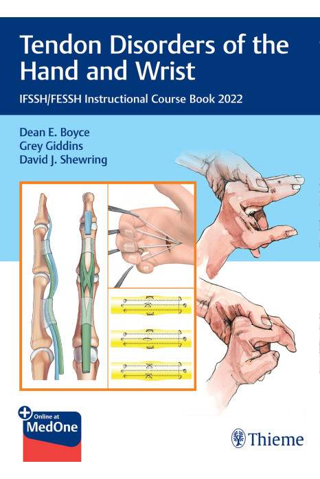 Tendon Disorders of the Hand and Wrist